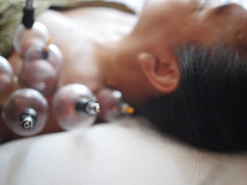 More Than Needles - General Acupuncture