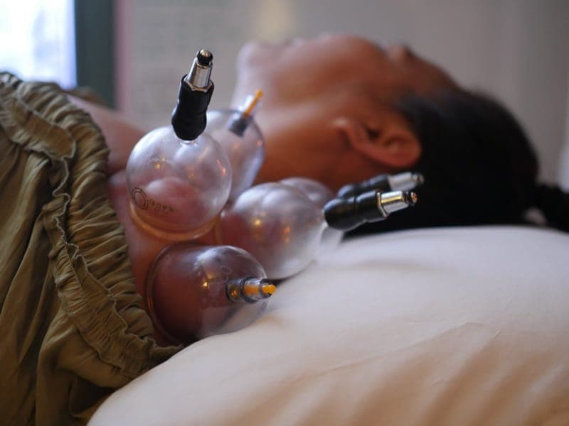 More Than Needles - General Acupuncture