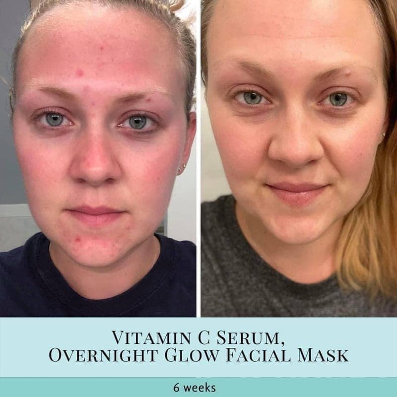 Our skincare has amazing results!!!